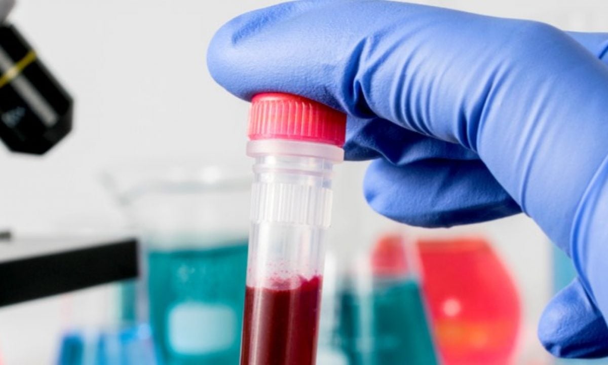 Alvarez & Marsal administrators appointed to seek buyer for Scottish biotech TC BioPharm